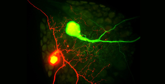 Le radici e il futuro della neurofisiologia