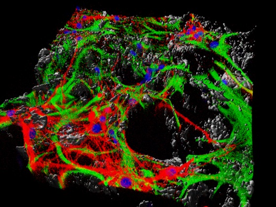 Una “spugna” per coltivare neuroni